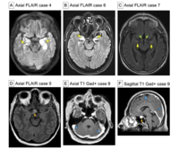 Central Nervous Image