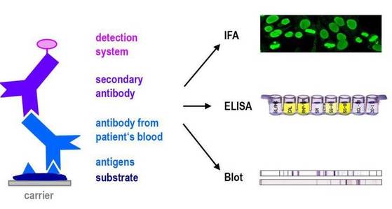 Abs Detection